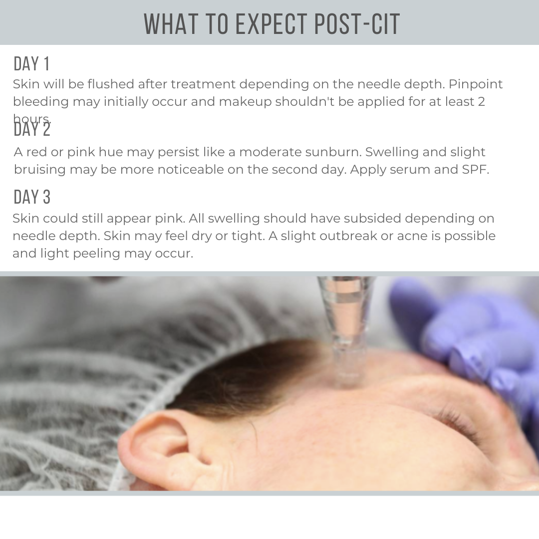 What to Expect Post-CIT - 1