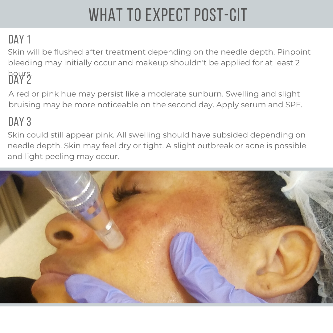 What to Expect After CIT - 2