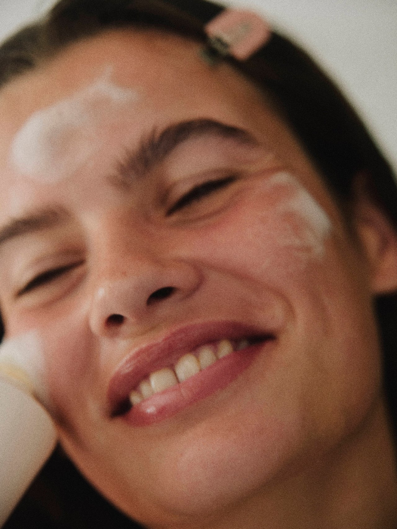 Best Active Ingredients for Post-Chemical Peel Recovery