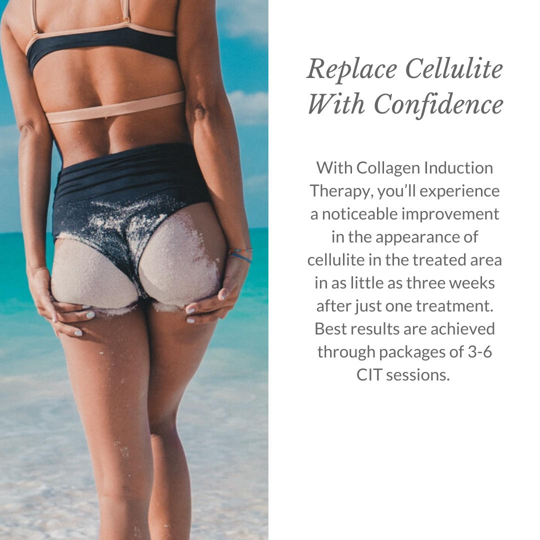 Replace Cellulite With Confidence - Italic 1080x1080