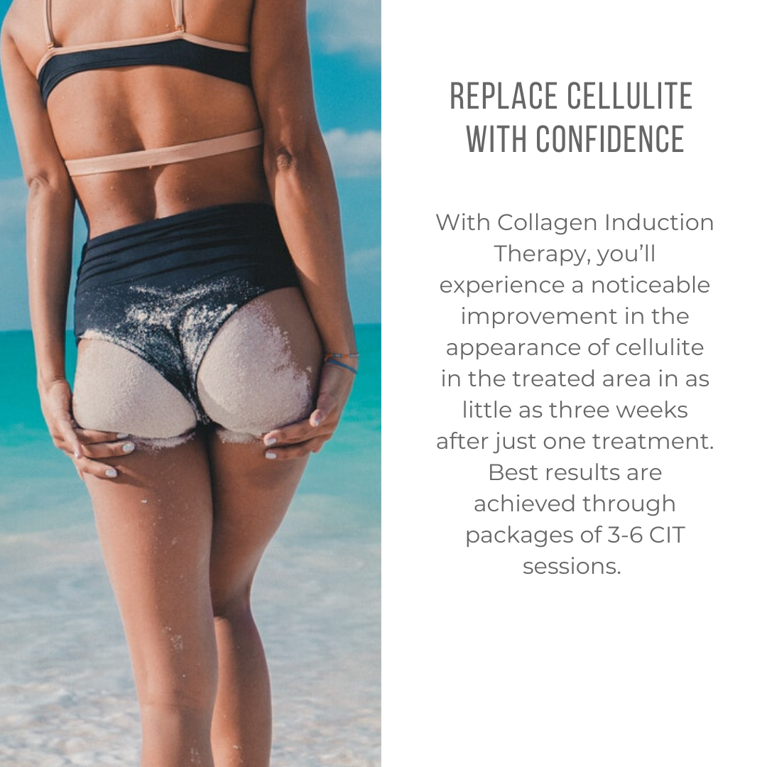 Replace Cellulite With Confidence - All Cap 1080x1080