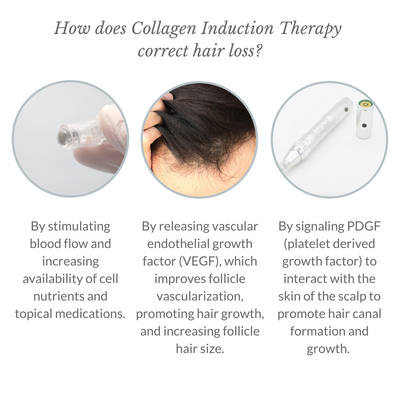 How Does Collagen Induction Therapy correct hair loss - Italic - 1080x1080