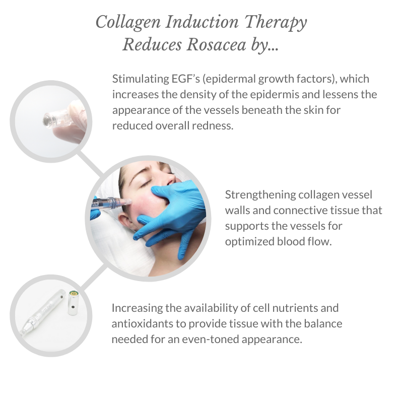 Collagen Induction Therapy Reduces Rosacea By... - Italics - 1080x1080