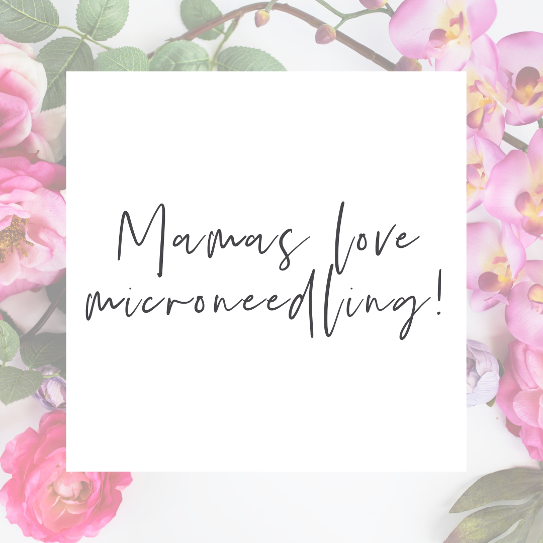 Mamas Love Microneedling (White)