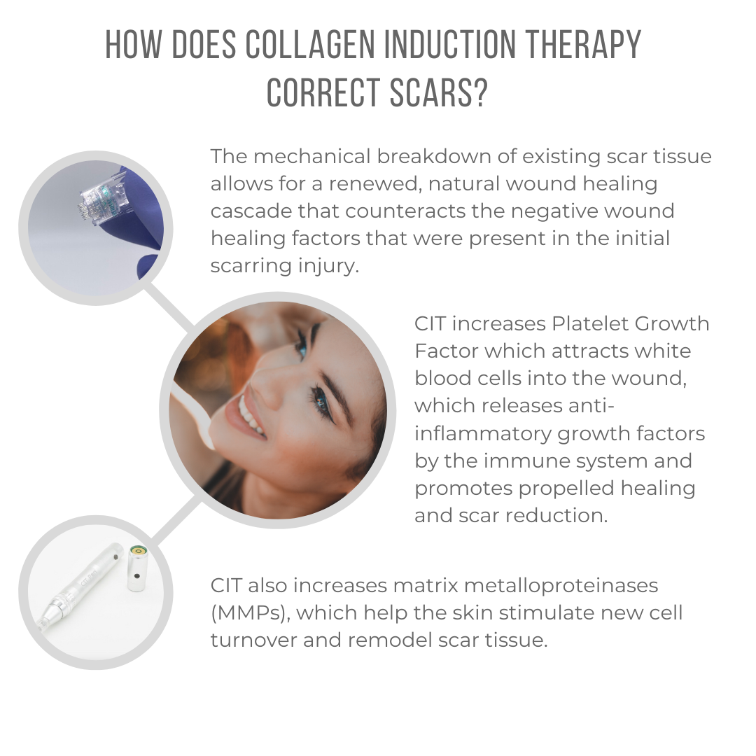 How does Collagen Induction Therapy correct scars? - 1080x1080