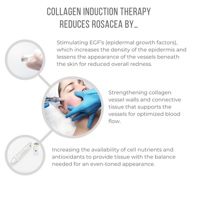 Collagen Induction Therapy Reduces Rosacea By... - All Caps - 1080x1080