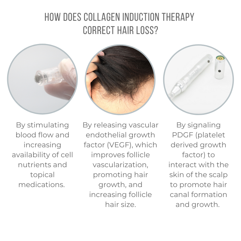 How Does Collagen Induction Therapy correct hair loss - All Cap - 1080x1080