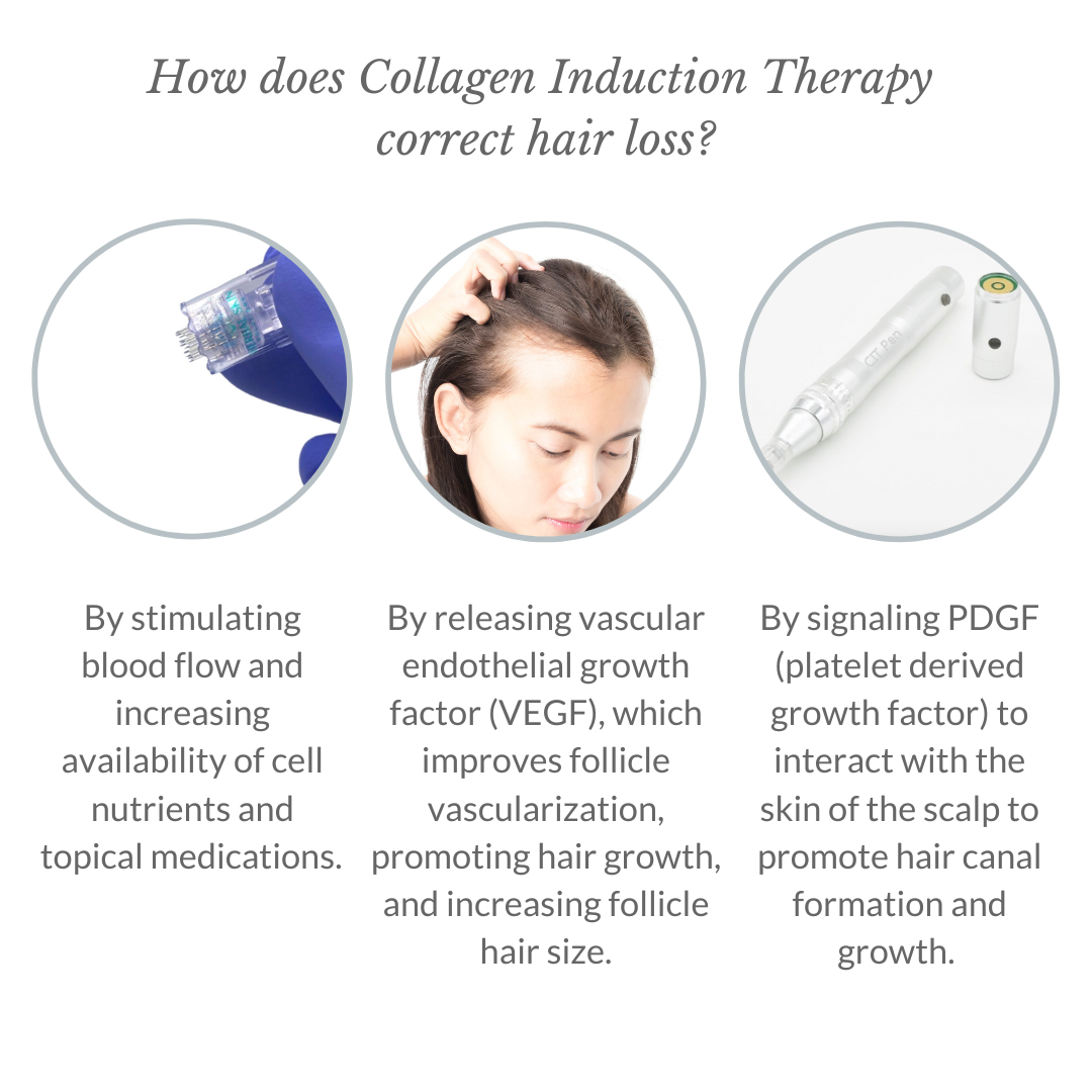 How Does Collagen Induction Therapy correct hair loss - Italic - 1080x1080