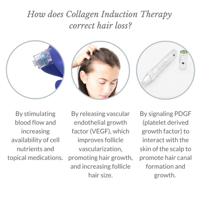How Does Collagen Induction Therapy correct hair loss - Italic - 1080x1080