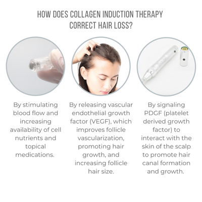 How Does Collagen Induction Therapy correct hair loss - All Cap - 1080x1080