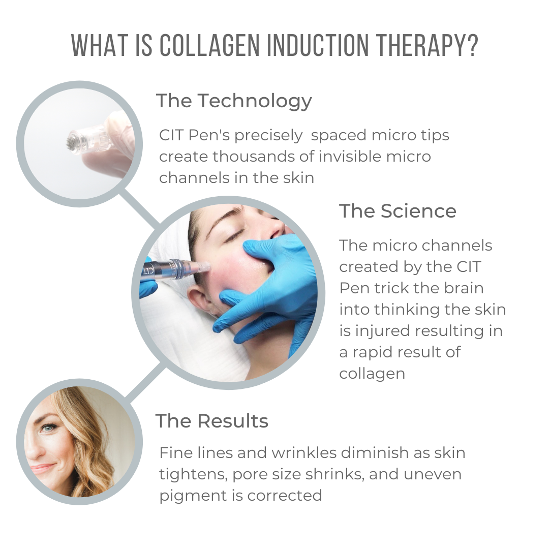 What is Collagen Induction Therapy? - 1080x1080