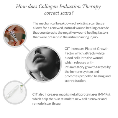 How does Collagen Induction Therapy correct scars? - 1080x1080