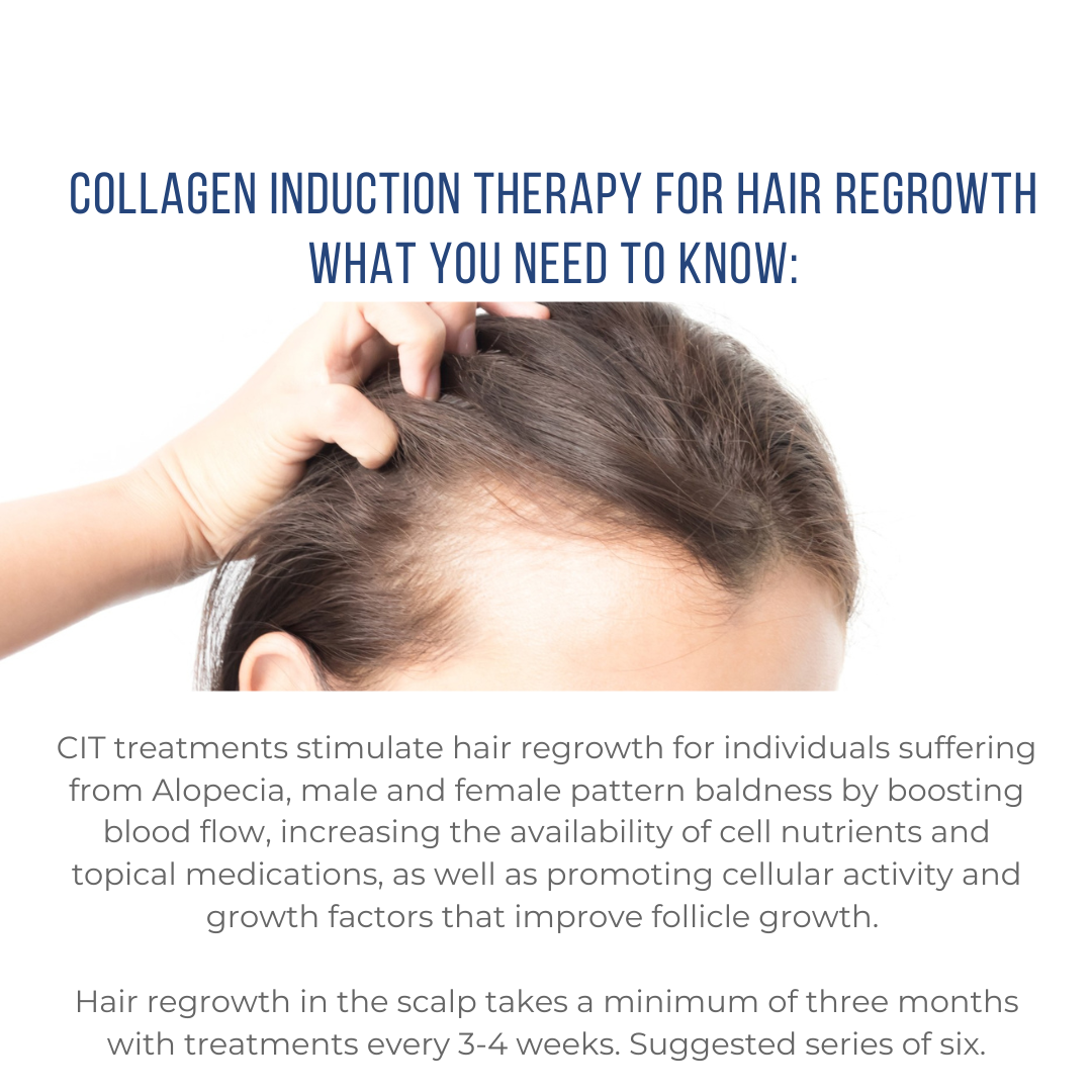 Collagen Induction Therapy for Hair Regrowth - All Cap - 1080x1080