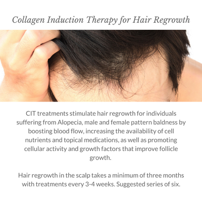 Collagen Induction Therapy for Hair Regrowth - Italic - 800x800