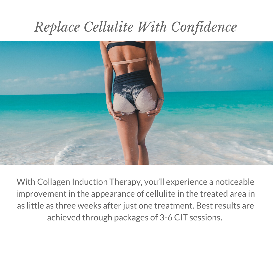 Replace Cellulite With Confidence - Italic 1080x1080