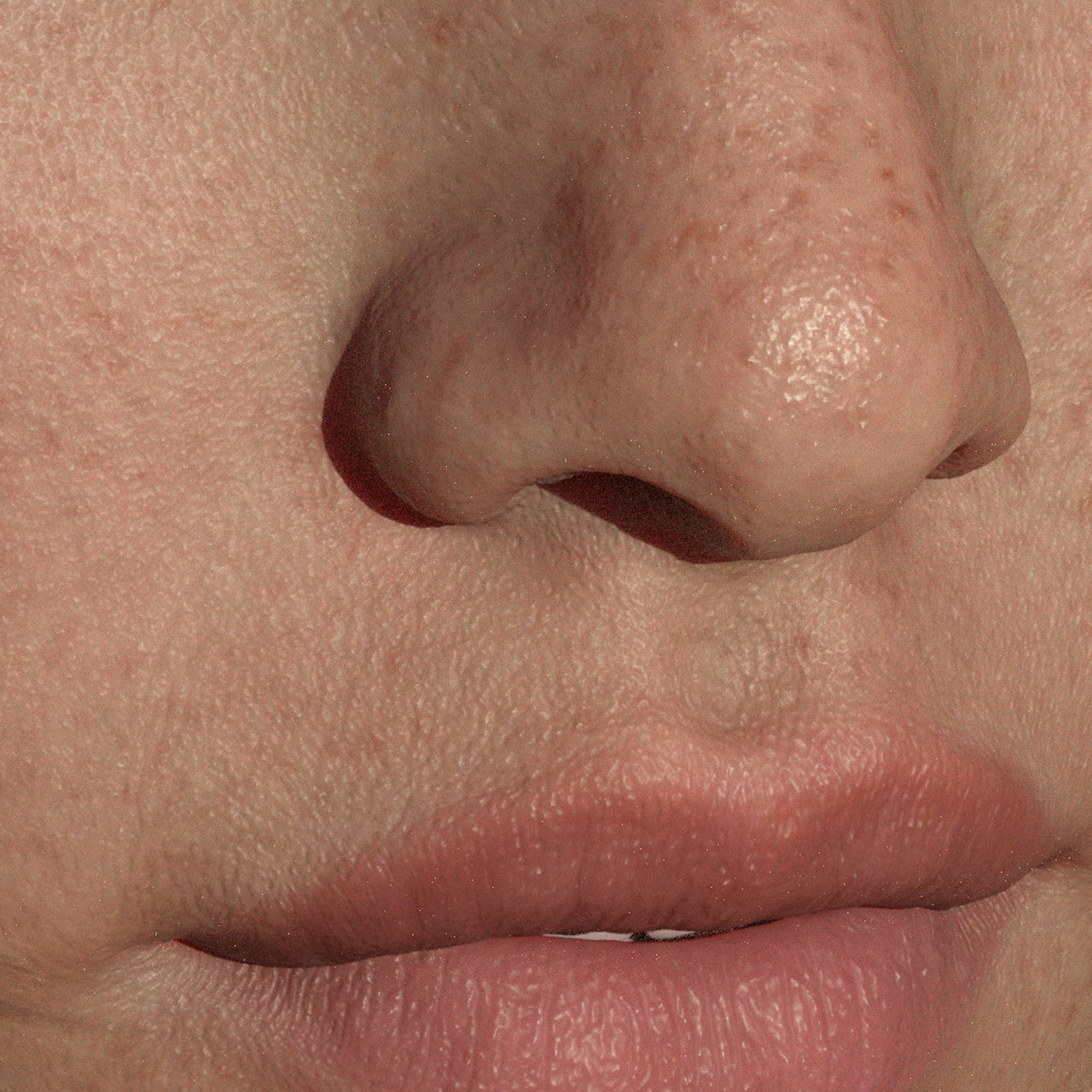 L-Mandelic Acid: The Gentle AHA for Acne and Hyperpigmentation