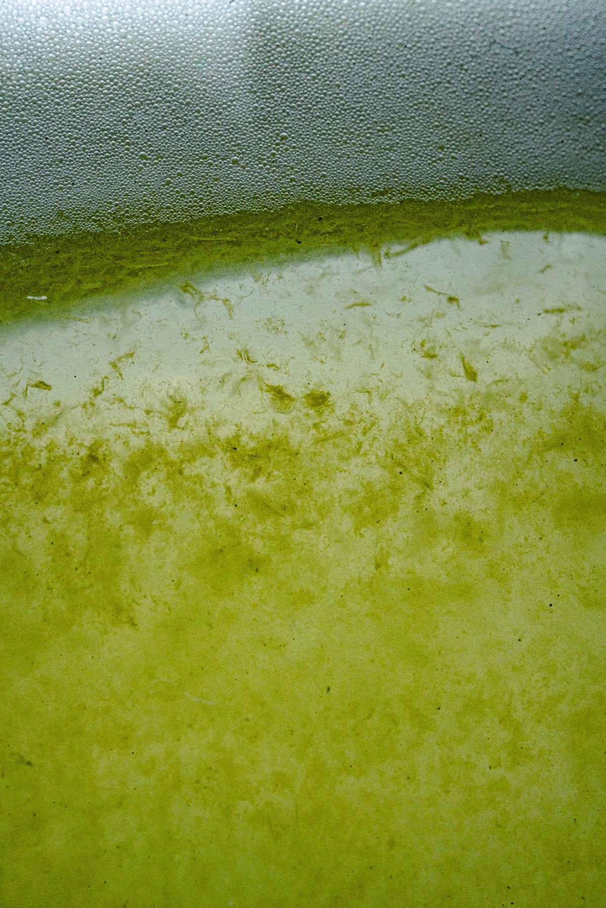 Which Acid is Best for Your Skin Type, AHAs vs. BHAs